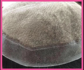 Hair Patches