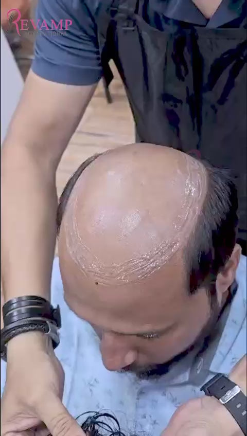 Mirage Silk Base Hair Patch - Luxurious Hair Replacement Solution